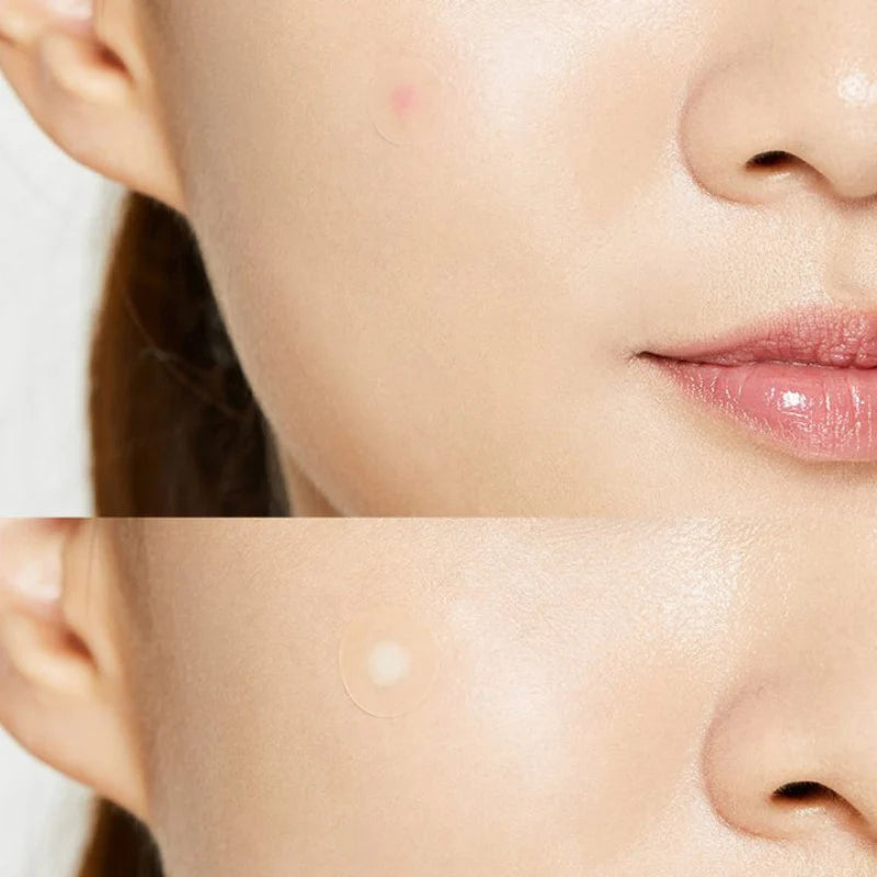 COSRX ACNE PIMPLE MASTER PATCH
